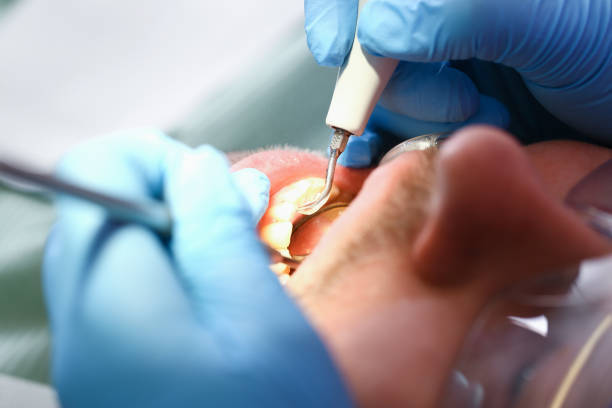 Best Emergency Dentist for Special Needs Patients in Cao, ND