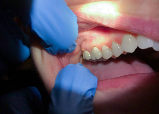  Cao, ND Emergency Dentist Pros