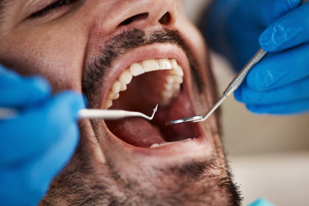  Cao, ND Emergency Dentist Pros
